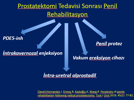 Radikal Prostatektomi Sonrası Erektil Disfonksiyon